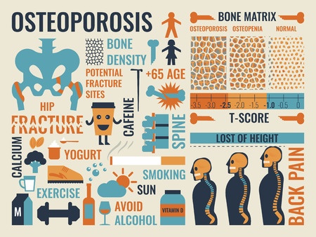 Image result for treat osteoporosis